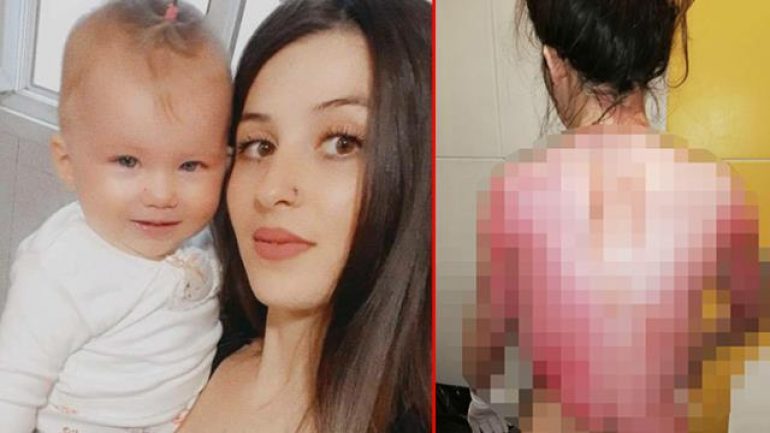 Kadın şiddeti bitmiyor! Eşinin ve kızını kaynar suyla haşladı