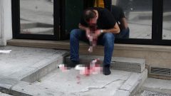 İstanbul’da korku dolu anlar! Mermi çenesinden girdi alnından çıktı