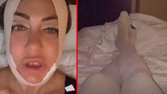 Yeliz Yeşilmen estetik operasyonu geçirdi! Bir detay dikkat çekti