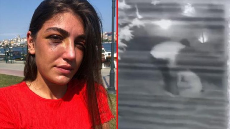 Manken Gizem Akbaş’a gece kulübünde öldüresiye dayak!