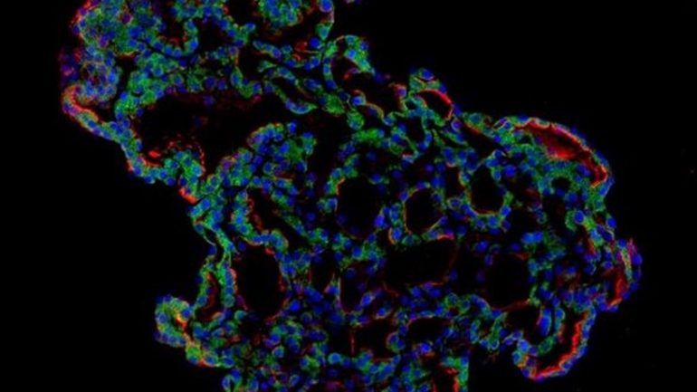 Koronavirüsün akciğerlerde izlediği yol adım adım görüntülendi