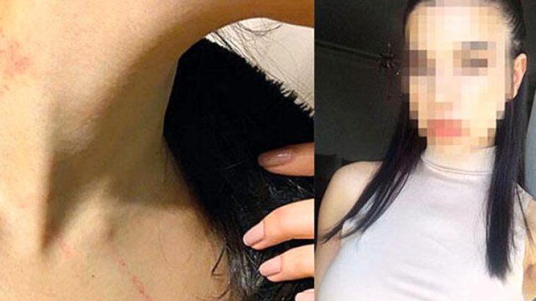 Lüks otelde taciz: Beni sürükleyip bir odaya götürdü, kapıyı kapattı…