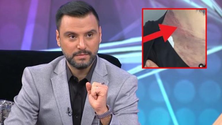 Alişan: Liposuction yaptırdım, ölümden döndüm