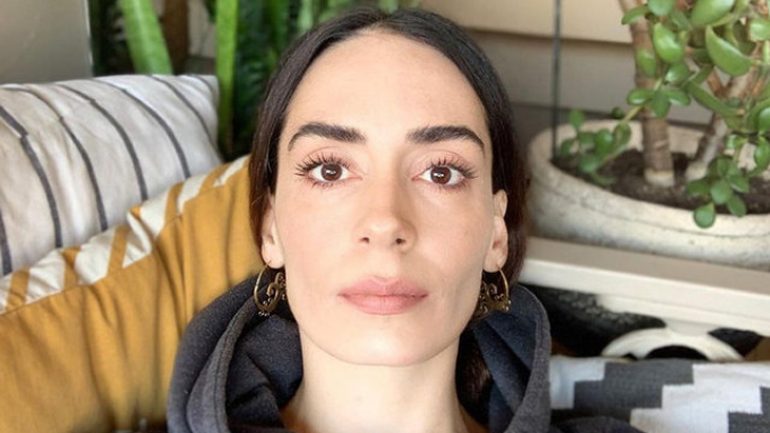 Oyuncu Melisa Sözen’den estetik itirafı!