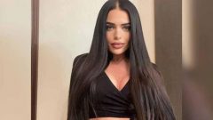 Estetik ameliyatı olan TV yıldızının burnu çürümeye başladı!