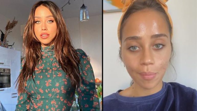 Zeynep Alkan soon halini paylaştı: Özgüvenim sıfır