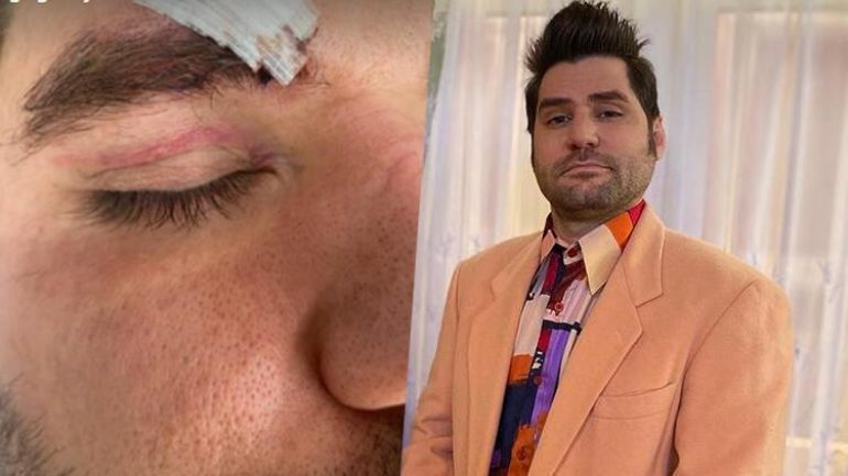 Oyuncu Ceyhun Fersoy saldırıya uğradı!