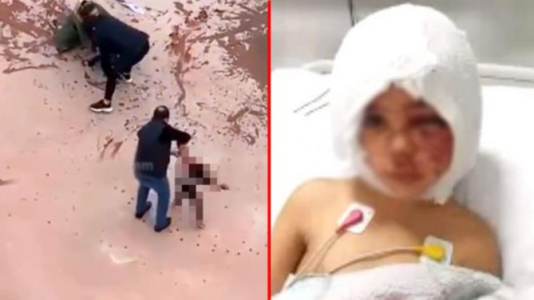 Pitbull saldırısına uğrayan Asiye’den ilk hastane fotoğrafı geldi! Hayati tehlikesi devam ediyor